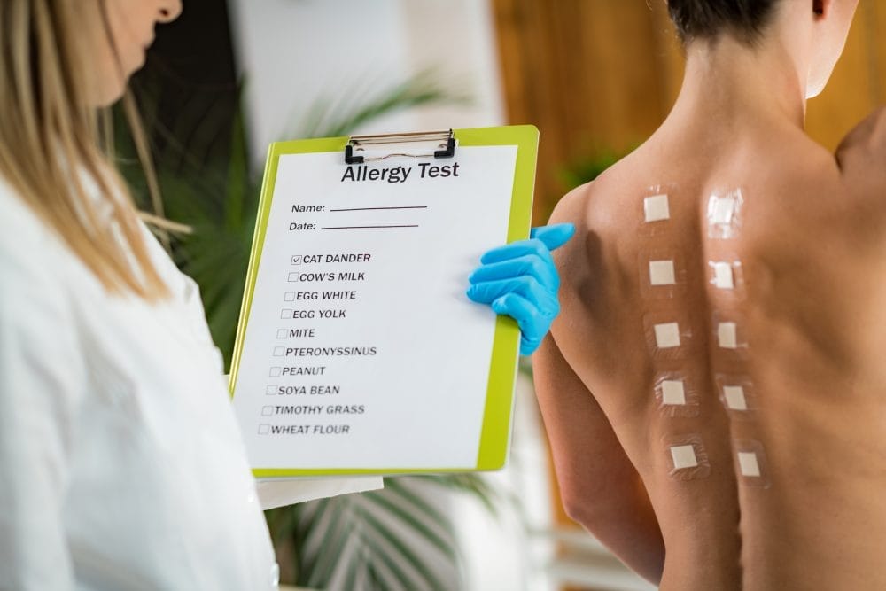 Someone getting a medical test to figure out their allergies